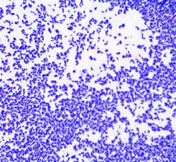 Acid-Fast-Staining