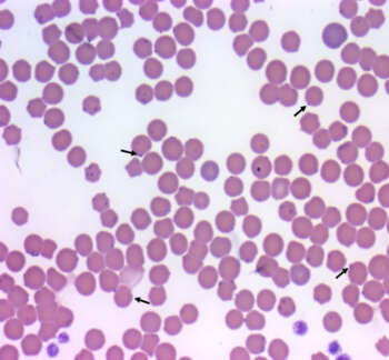 Babesia-Sp