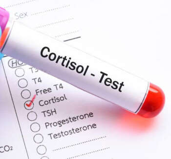 Cortisol