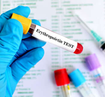 Erythropoietin