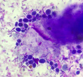 Faecal-Cytology