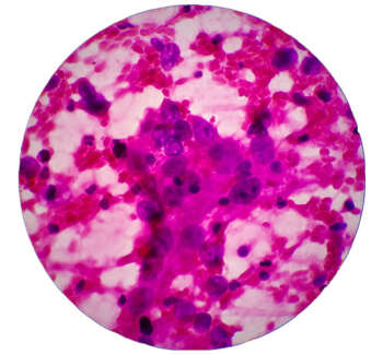 Fluid-Cytology