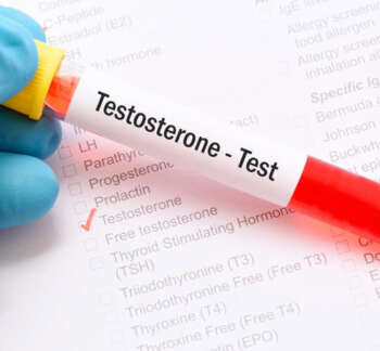 Free-Testosterone