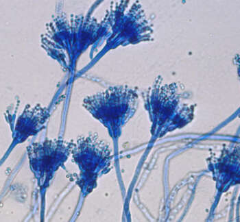 Fungal-Staining