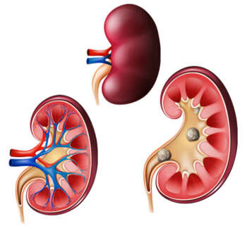 Kidney-Function-Test