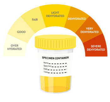 Urinary-Cortisol